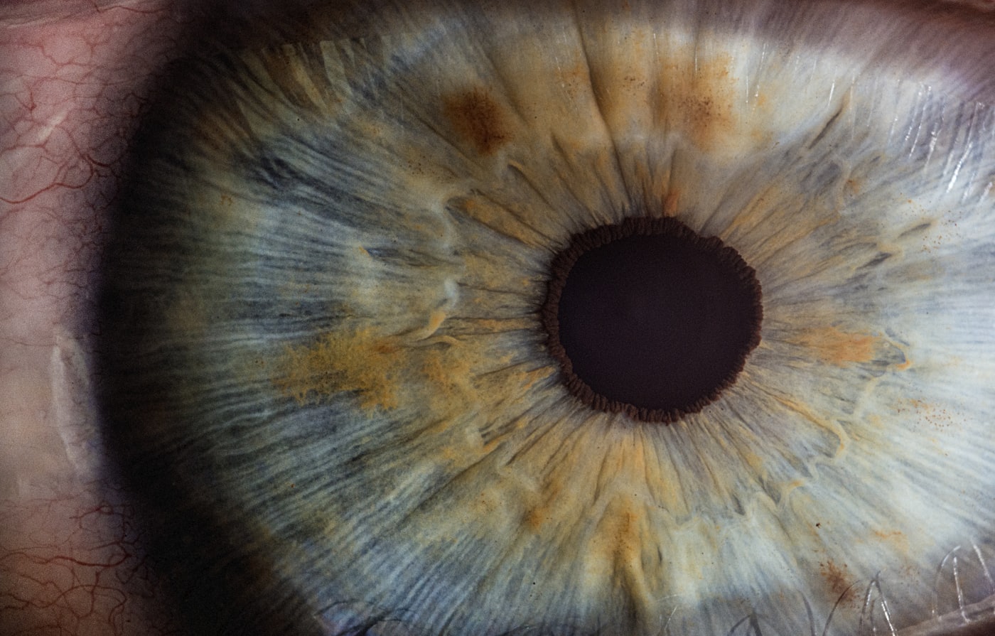Macro photograph of a human iris
